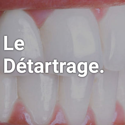 Le détartrage !